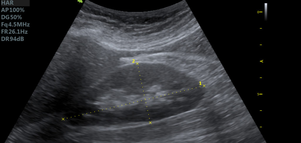 Darstellung der medizinischen Leistung Sonografie